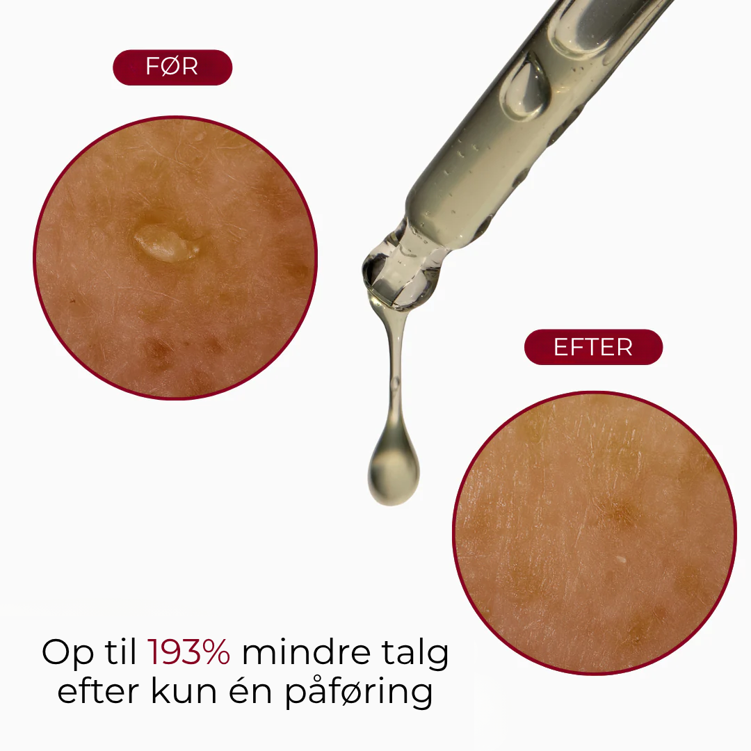 RiceRevital™ Essense Set | Serum Duo, fordi din hud kun fortjener det bedste