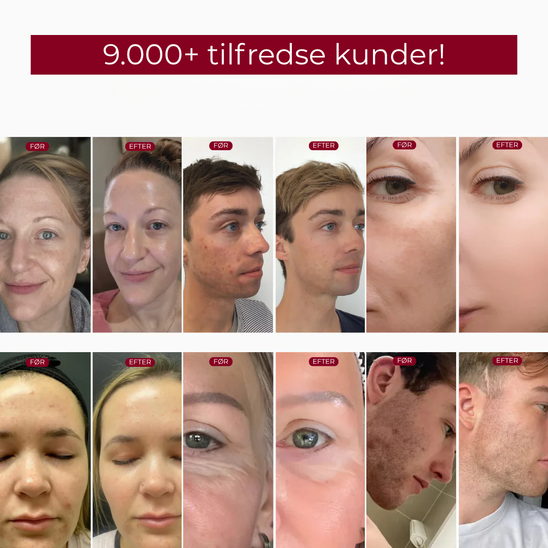 RiceRevital™ Essense Set | Serum Duo, fordi din hud kun fortjener det bedste