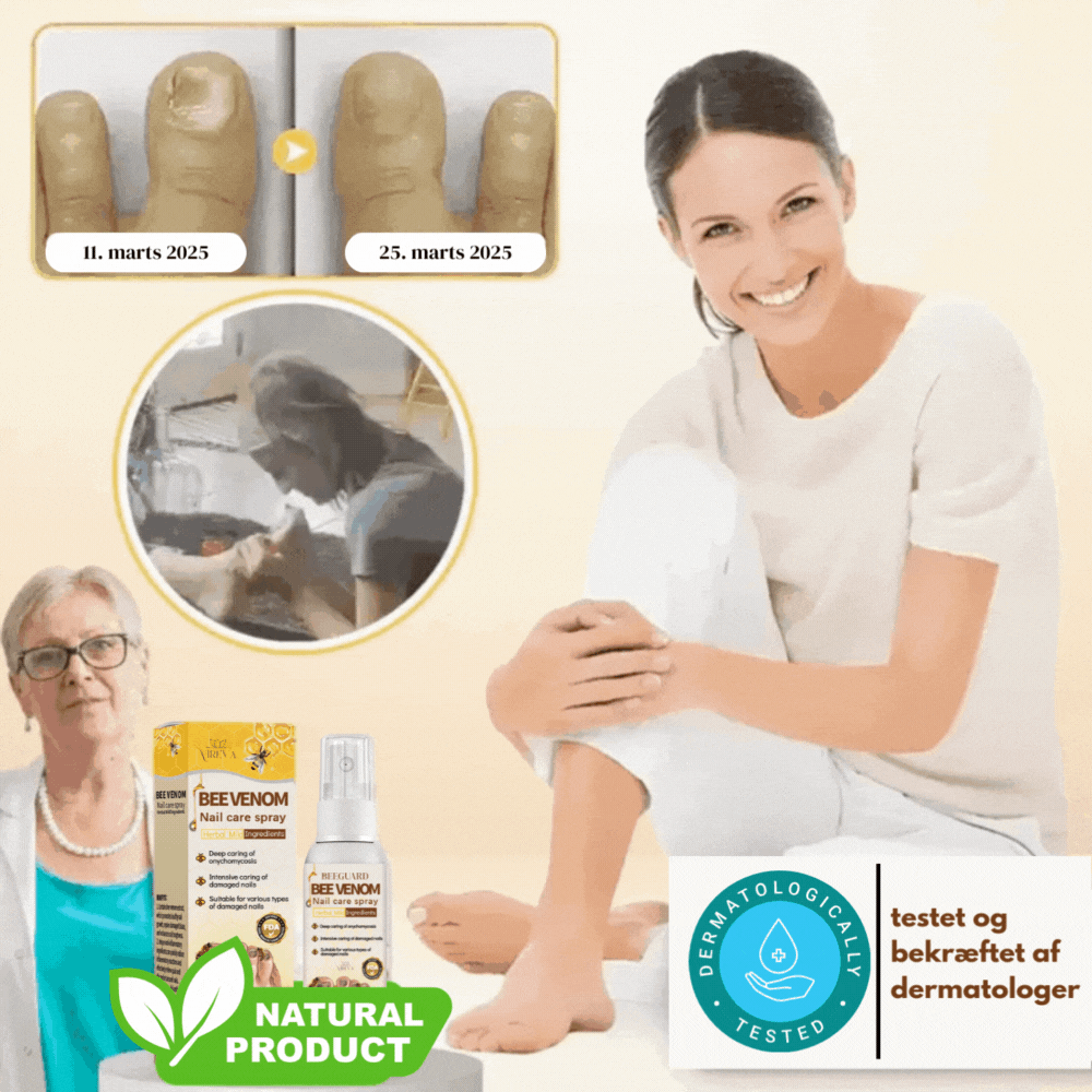 BeeGuard™ Neglespray – Farvel til neglesvamp på kun 14 dage!