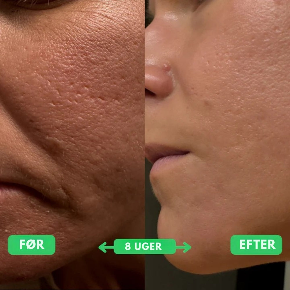 GlowRenew™ – Retinol Boost Face Oil