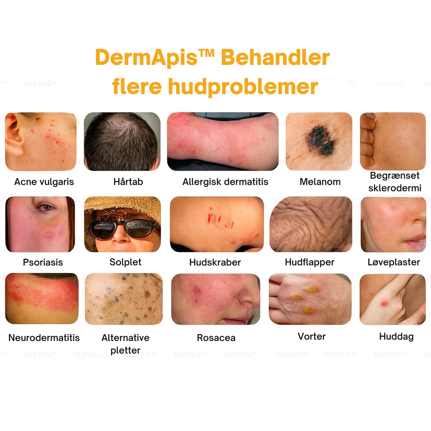 DermApis™ Hudreparerende Creme – Naturlig lindring stærkere hud