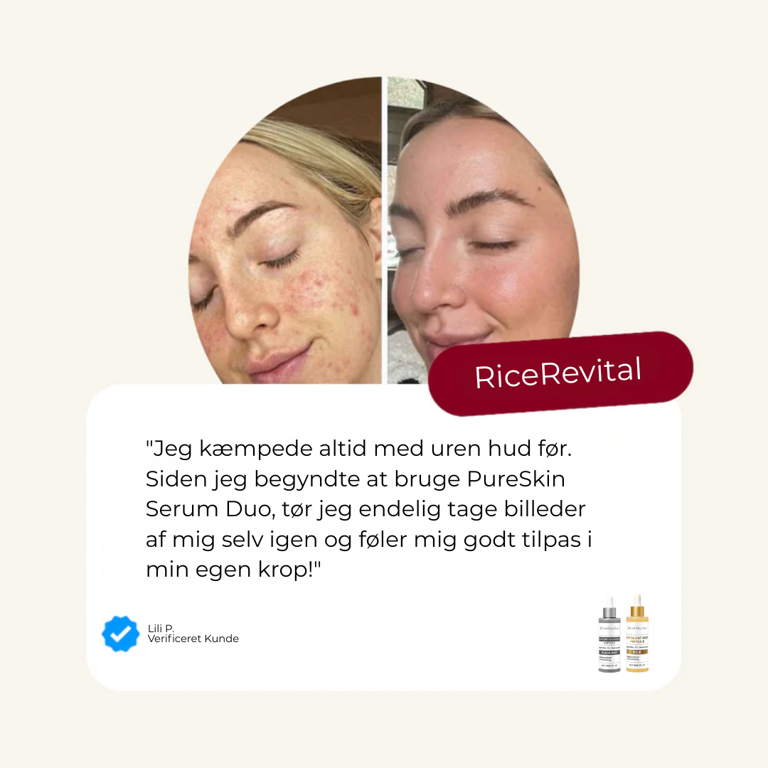 RiceRevital™ Essense Set | Serum Duo, fordi din hud kun fortjener det bedste
