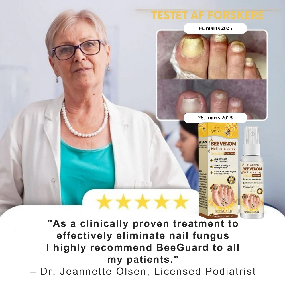 BeeGuard™ Neglespray – Farvel til neglesvamp på kun 14 dage!