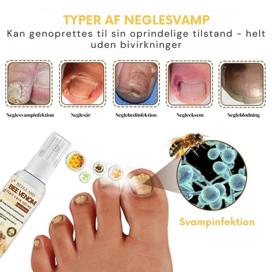 BeeGuard™ Neglespray – Farvel til neglesvamp på kun 14 dage!