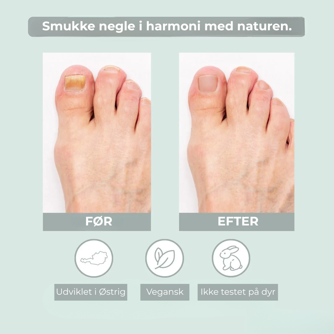 EcoCure™ Negleplejepen | Få stærke, smukke negle – helt naturligt!