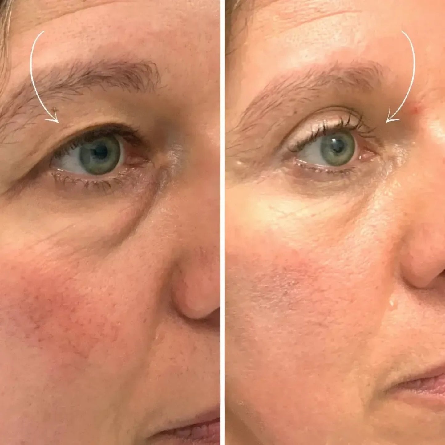 LineLift™ Cream – Løft dine øjenlåg naturligt ✨