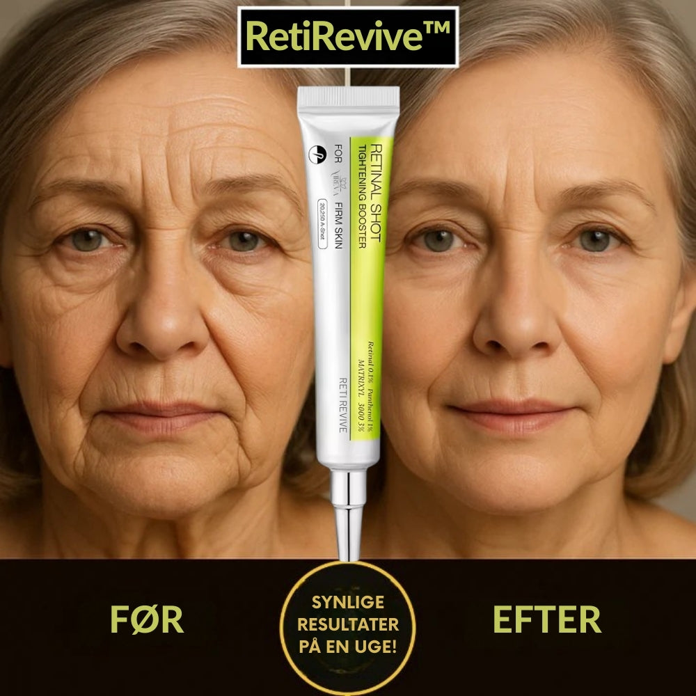 RetiRevive™ – Vågn op til yngre, friskere øjne ✨