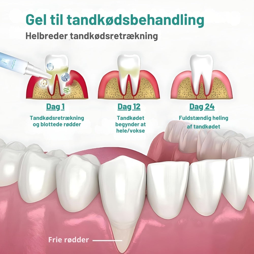 Oralis™ Tooth Recovery Gel – Genopbygger tandkødet og giver hvidere tænder på kun 1 uge