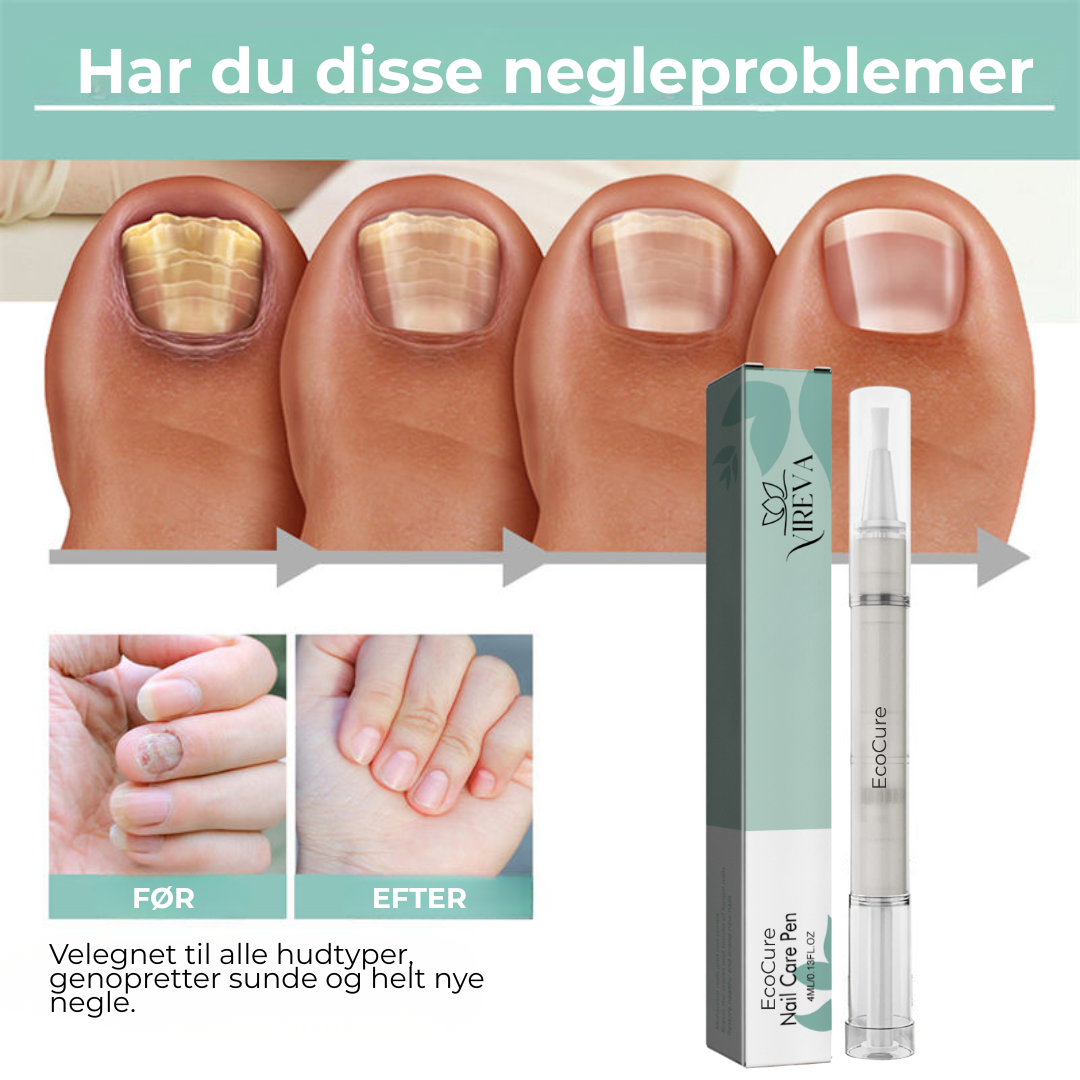 EcoCure™ Negleplejepen | Få stærke, smukke negle – helt naturligt!