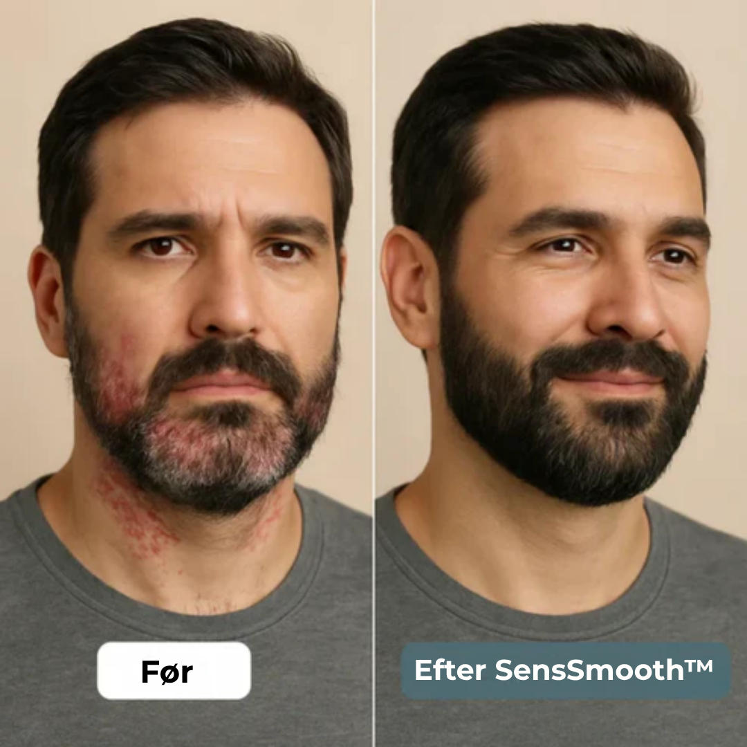 SensSmooth™ Cream | Berolig din hud på få dage 🌿✨