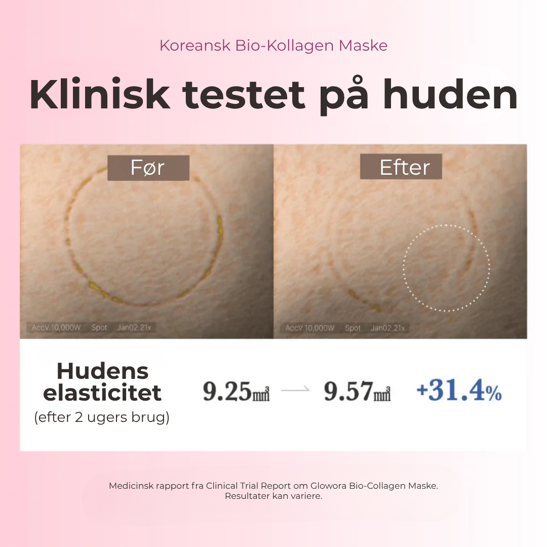 ShineGlow™ Collagen Mask | Viral koreansk natmaske