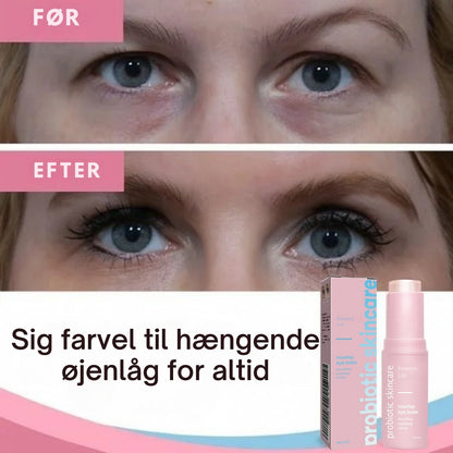 EssenceLift™ – Få et løft på kun 2 timer