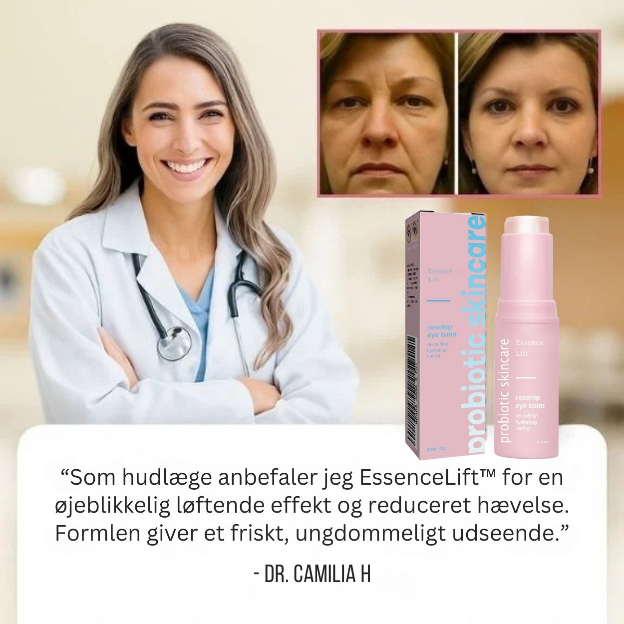 EssenceLift™ – Få et løft på kun 2 timer