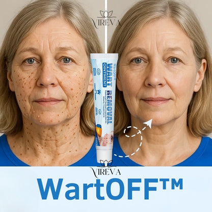 ✨ WattOff™ – Fjern vorter, hudflapper & knopper på kun 7 dage!