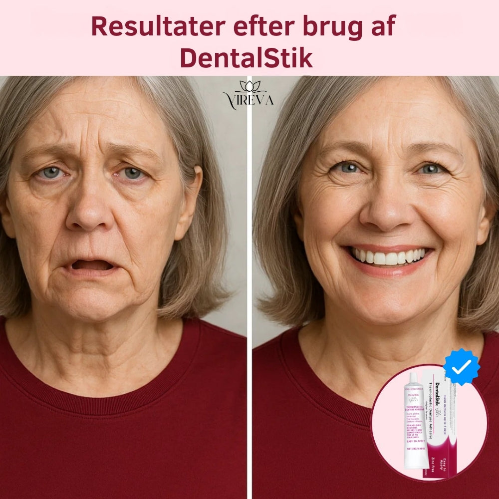 DentalStik™ | Holder din protese sikkert på plads i op til 3 dage – helt uden eftersmag!
