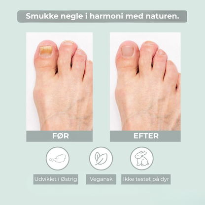 EcoCure™ Negleplejepen | Få stærke, smukke negle – helt naturligt!