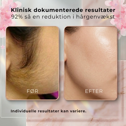 Aura Cyperus Rotundus Oil | Opnå silkeblød hud naturligt uden daglig barbering