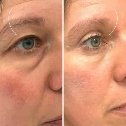 LineLift™ Cream – Løft dine øjenlåg naturligt ✨
