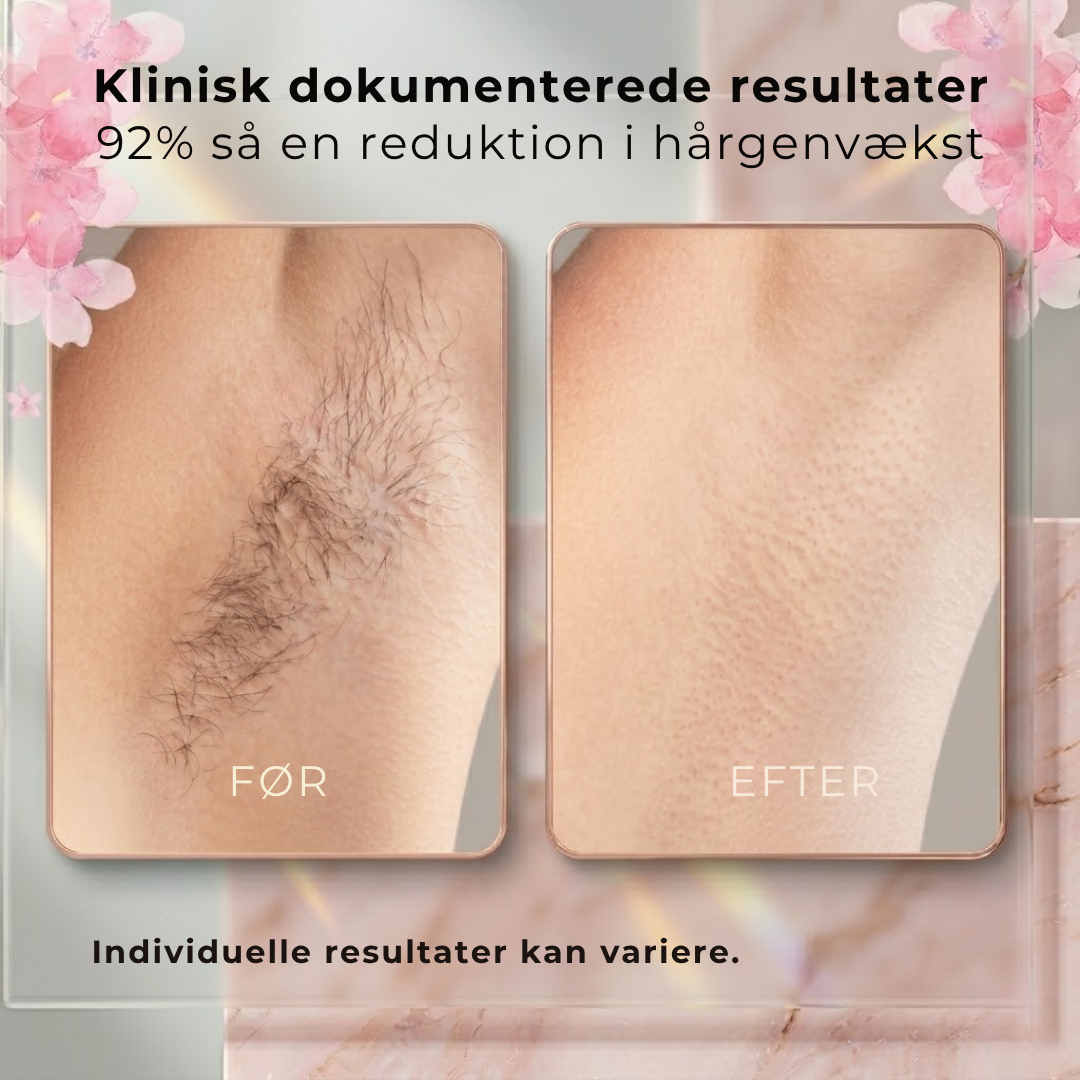 Aura Cyperus Rotundus Oil | Opnå silkeblød hud naturligt uden daglig barbering