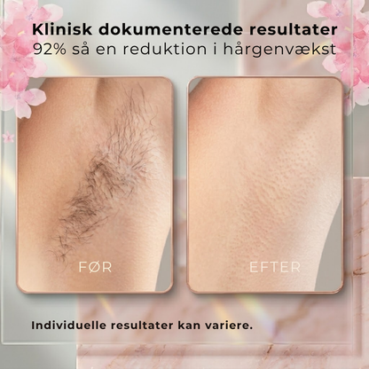 Aura Cyperus Rotundus Oil | Opnå silkeblød hud naturligt uden daglig barbering