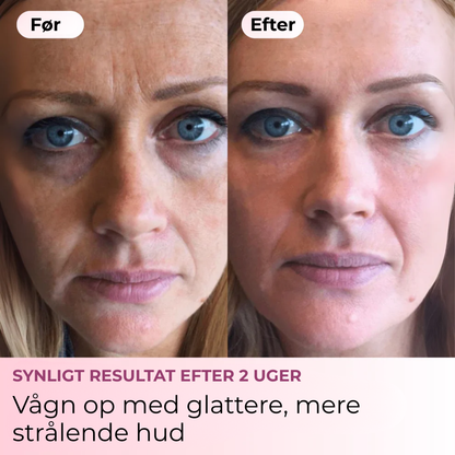 ShineGlow™ Collagen Mask | Viral koreansk natmaske