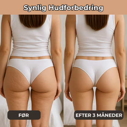 NovaForm™ Leggings | Innovativ 3D Anti-Cellulite Leggings