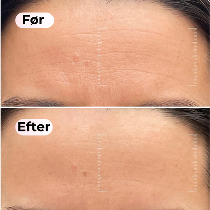 ShineGlow™ Collagen Mask | Viral koreansk natmaske