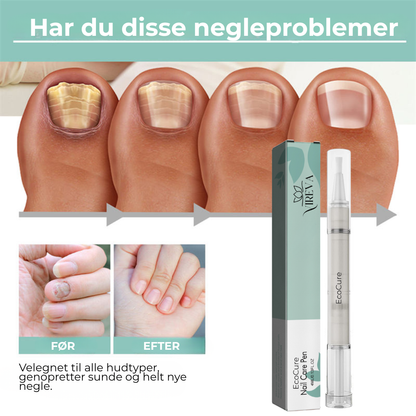 EcoCure™ Negleplejepen | Få stærke, smukke negle – helt naturligt!