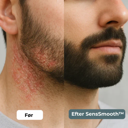 SensSmooth™ Cream | Berolig din hud på få dage 🌿✨