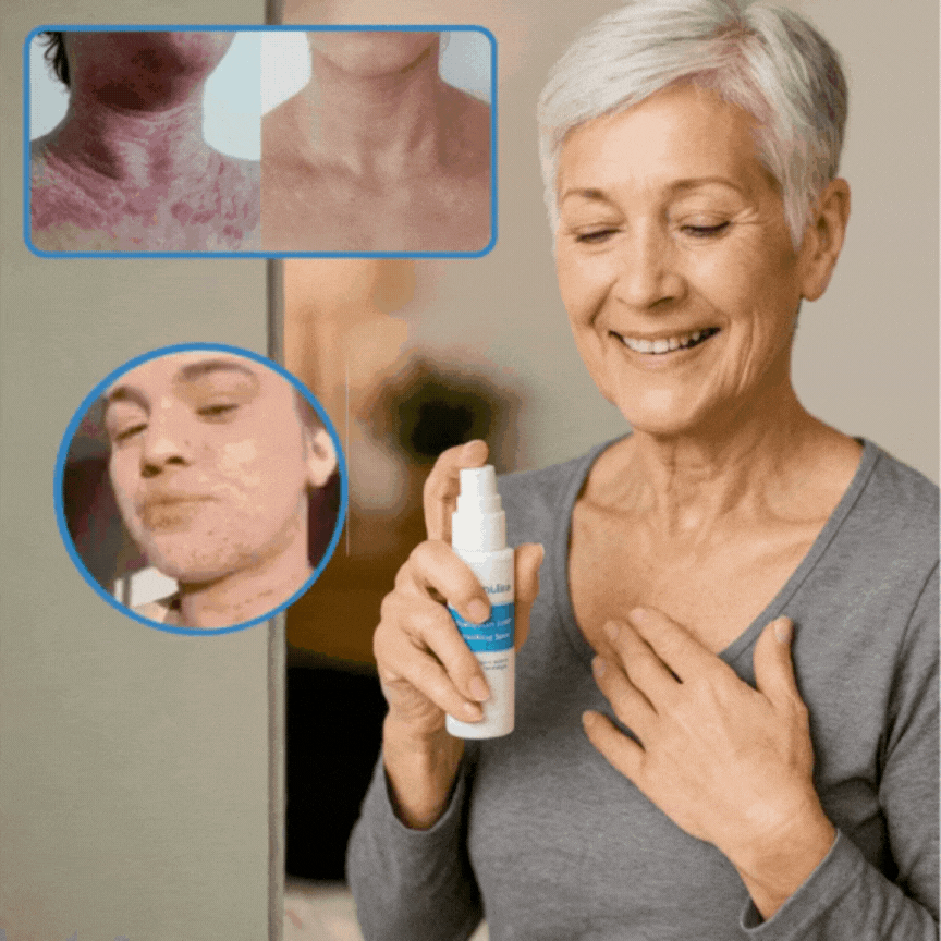 HudRo™ | Eksem Beroligende Hudspray