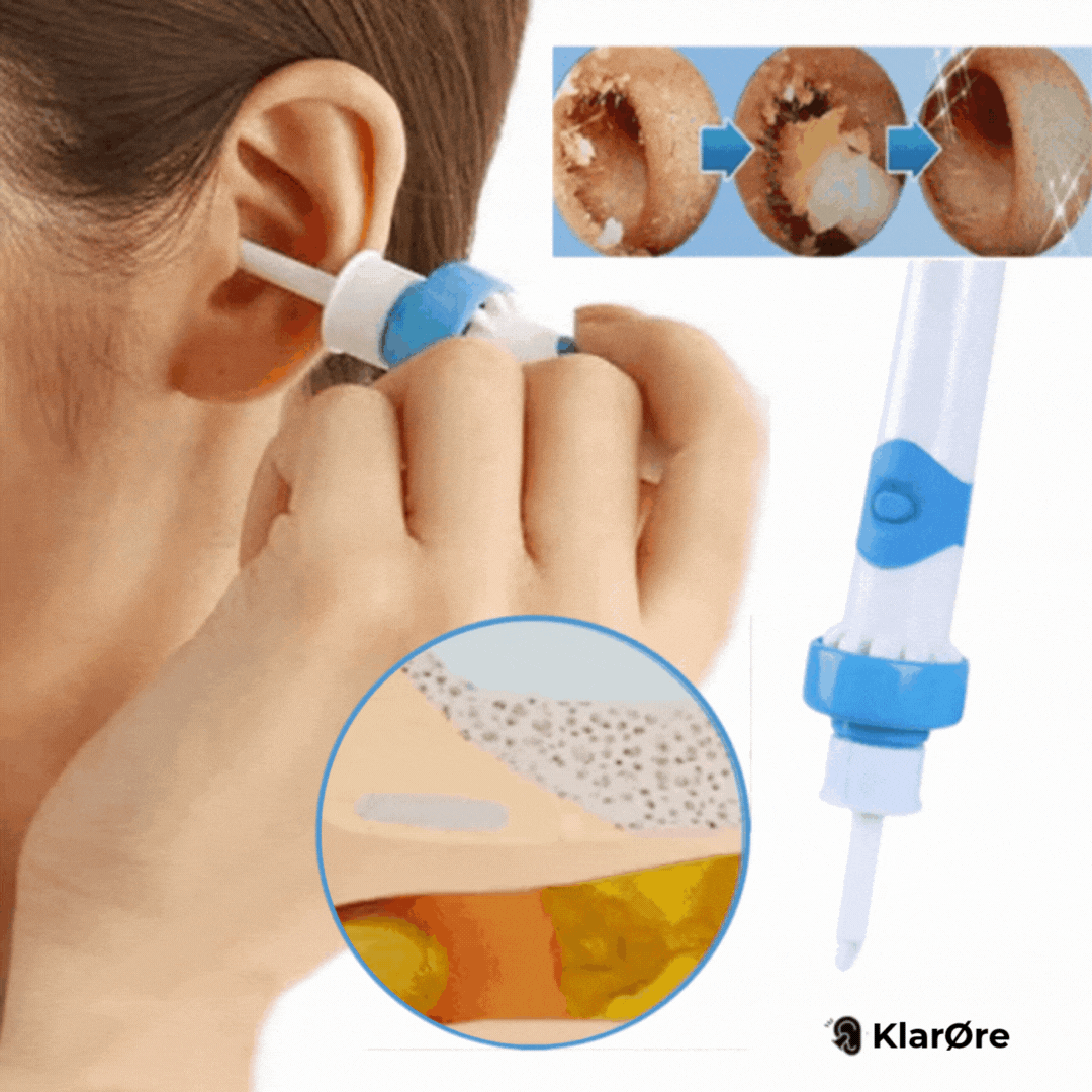 KlarØre™ | Fjern blokeringer og tryk i dine ører på 60 sekunder – helt smertefrit.
